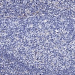 Invitrogen KLHL32 Polyclonal Antibody 100 &mu;L | Buy Online | Invitrogen&trade; | Fisher Scientific