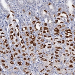 ATP4A Polyclonal Antibody:Antibodies, Polyclonal