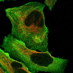 Invitrogen DQX1 Polyclonal Antibody 100 &mu;L; Unconjugated:Antibodies,
