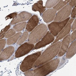 Invitrogen MYOZ3 Polyclonal Antibody 100 &mu;L | Buy Online | Invitrogen&trade; | Fisher Scientific