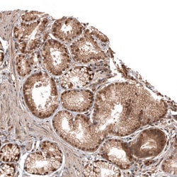 Invitrogen OTUB1 Polyclonal Antibody 100 &mu;L; Unconjugated:Antibodies,