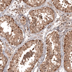 Invitrogen OTUB1 Polyclonal Antibody 100 &mu;L; Unconjugated:Antibodies,