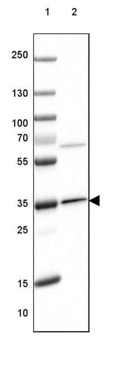 Invitrogen OTUB1 Polyclonal Antibody 100 &mu;L; Unconjugated:Antibodies,