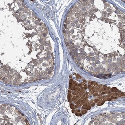 Invitrogen TEX35 Polyclonal Antibody 100 &mu;L; Unconjugated:Antibodies,