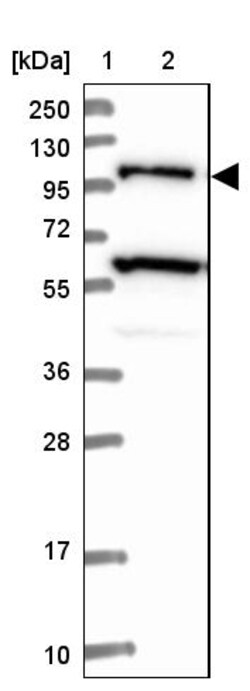 Invitrogen USP6NL Polyclonal Antibody 100 &mu;L | Buy Online | Invitrogen&trade; | Fisher Scientific