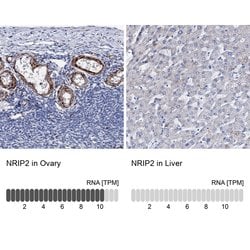 Invitrogen NRIP2 Polyclonal Antibody 100 &mu;L; Unconjugated:Antibodies,