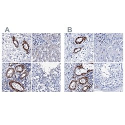 Invitrogen NRIP2 Polyclonal Antibody 100 &mu;L; Unconjugated:Antibodies,