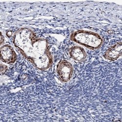 Invitrogen NRIP2 Polyclonal Antibody 100 &mu;L; Unconjugated:Antibodies,