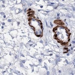 Invitrogen NRIP2 Polyclonal Antibody 100 &mu;L; Unconjugated:Antibodies,