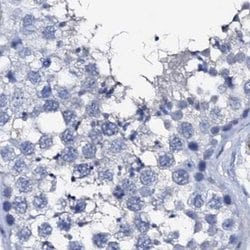 Invitrogen NRIP2 Polyclonal Antibody 100 &mu;L; Unconjugated:Antibodies,