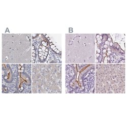 Invitrogen ACY3 Polyclonal Antibody 100 &mu;L; Unconjugated:Antibodies,