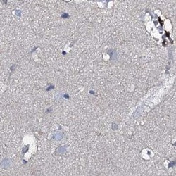 Invitrogen ACY3 Polyclonal Antibody 100 &mu;L; Unconjugated:Antibodies,