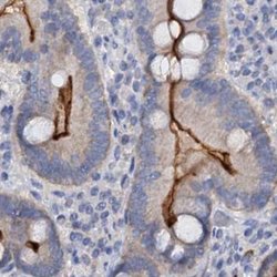 Invitrogen ACY3 Polyclonal Antibody 100 &mu;L; Unconjugated:Antibodies,