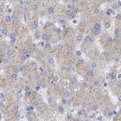 Invitrogen ACY3 Polyclonal Antibody 100 &mu;L; Unconjugated:Antibodies,