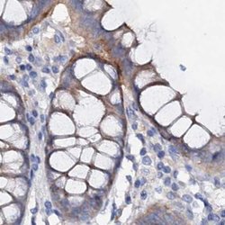 Invitrogen ACY3 Polyclonal Antibody 100 &mu;L; Unconjugated:Antibodies,