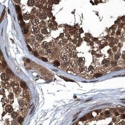Invitrogen RNH1 Polyclonal Antibody 100 &mu;L | Buy Online | Invitrogen&trade; | Fisher Scientific