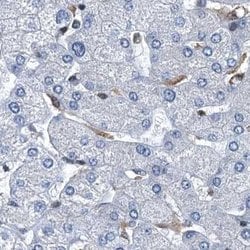 Invitrogen RNH1 Polyclonal Antibody 100 &mu;L | Buy Online | Invitrogen&trade; | Fisher Scientific