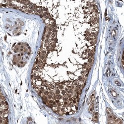 Invitrogen RNH1 Polyclonal Antibody 100 &mu;L | Buy Online | Invitrogen&trade; | Fisher Scientific