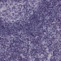 Invitrogen ODF3 Polyclonal Antibody 100 &mu;L; Unconjugated:Antibodies,