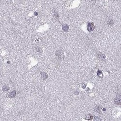 Invitrogen ODF3 Polyclonal Antibody 100 &mu;L; Unconjugated:Antibodies,