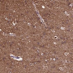 Invitrogen TUBA1A Polyclonal Antibody 100 &mu;L; Unconjugated:Antibodies,