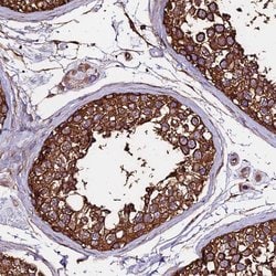 Invitrogen TUBA1A Polyclonal Antibody 100 &mu;L; Unconjugated:Antibodies,