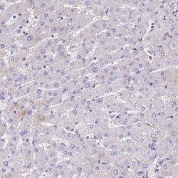Invitrogen TUBA1A Polyclonal Antibody 100 &mu;L; Unconjugated:Antibodies,