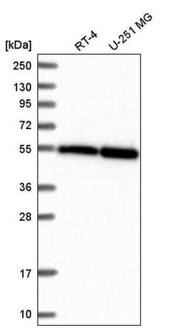 Invitrogen TUBA1A Polyclonal Antibody 100 &mu;L; Unconjugated:Antibodies,