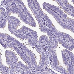 Invitrogen LRRC18 Polyclonal Antibody 100 &mu;L; Unconjugated:Antibodies,