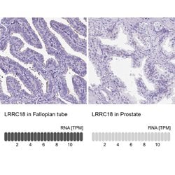 Invitrogen LRRC18 Polyclonal Antibody 100 &mu;L; Unconjugated:Antibodies,