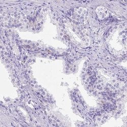 Invitrogen LRRC18 Polyclonal Antibody 100 &mu;L; Unconjugated:Antibodies,