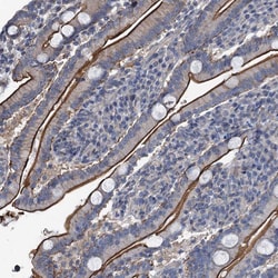 Invitrogen IFITM5 Polyclonal Antibody 100 &mu;L | Buy Online | Invitrogen&trade; | Fisher Scientific