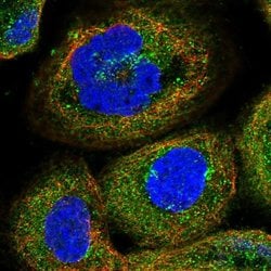 Invitrogen PEX5 Polyclonal Antibody 100 &mu;L; Unconjugated:Antibodies,