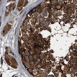 Invitrogen PEX5 Polyclonal Antibody 100 &mu;L; Unconjugated:Antibodies,