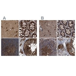 Invitrogen PEX5 Polyclonal Antibody 100 &mu;L; Unconjugated:Antibodies,