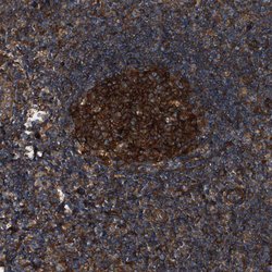 Invitrogen PEX5 Polyclonal Antibody 100 &mu;L; Unconjugated:Antibodies,