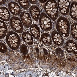 Invitrogen PEX5 Polyclonal Antibody 100 &mu;L; Unconjugated:Antibodies,