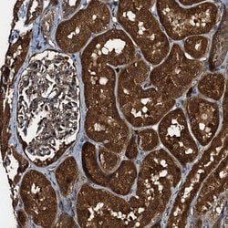 Invitrogen PEX5 Polyclonal Antibody 100 &mu;L; Unconjugated:Antibodies,