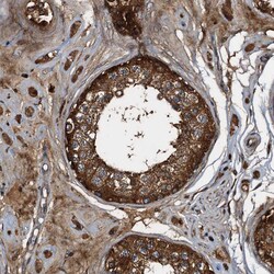 Invitrogen PEX5 Polyclonal Antibody 100 &mu;L; Unconjugated:Antibodies,