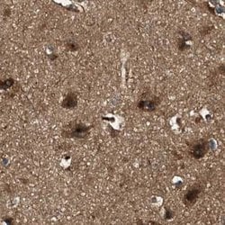 Invitrogen PEX5 Polyclonal Antibody 100 &mu;L; Unconjugated:Antibodies,