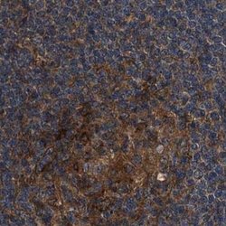 Invitrogen PEX5 Polyclonal Antibody 100 &mu;L; Unconjugated:Antibodies,