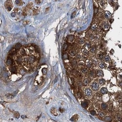 Invitrogen PEX5 Polyclonal Antibody 100 &mu;L; Unconjugated:Antibodies,