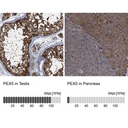 Invitrogen PEX5 Polyclonal Antibody 100 &mu;L; Unconjugated:Antibodies,