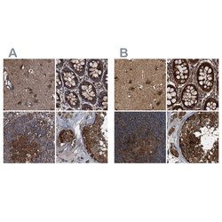 Invitrogen PEX5 Polyclonal Antibody 100 &mu;L; Unconjugated:Antibodies,