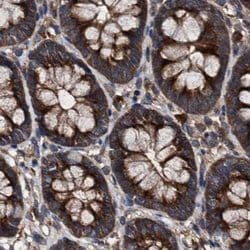 Invitrogen PEX5 Polyclonal Antibody 100 &mu;L; Unconjugated:Antibodies,