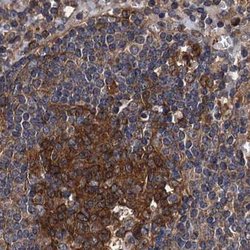 Invitrogen PEX5 Polyclonal Antibody 100 &mu;L; Unconjugated:Antibodies,