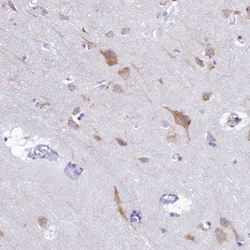 Invitrogen SKA3 Polyclonal Antibody 100 &mu;L; Unconjugated:Antibodies,