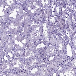 Invitrogen SKA3 Polyclonal Antibody 100 &mu;L; Unconjugated:Antibodies,
