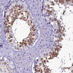 Invitrogen SKA3 Polyclonal Antibody 100 &mu;L; Unconjugated:Antibodies,