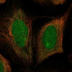Invitrogen DIS3 Polyclonal Antibody 100 &mu;L; Unconjugated:Antibodies,